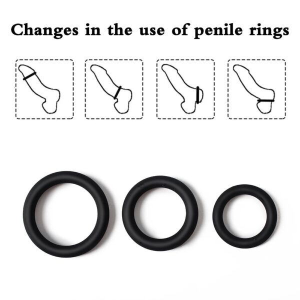Anillo Retardante - Imagen 4